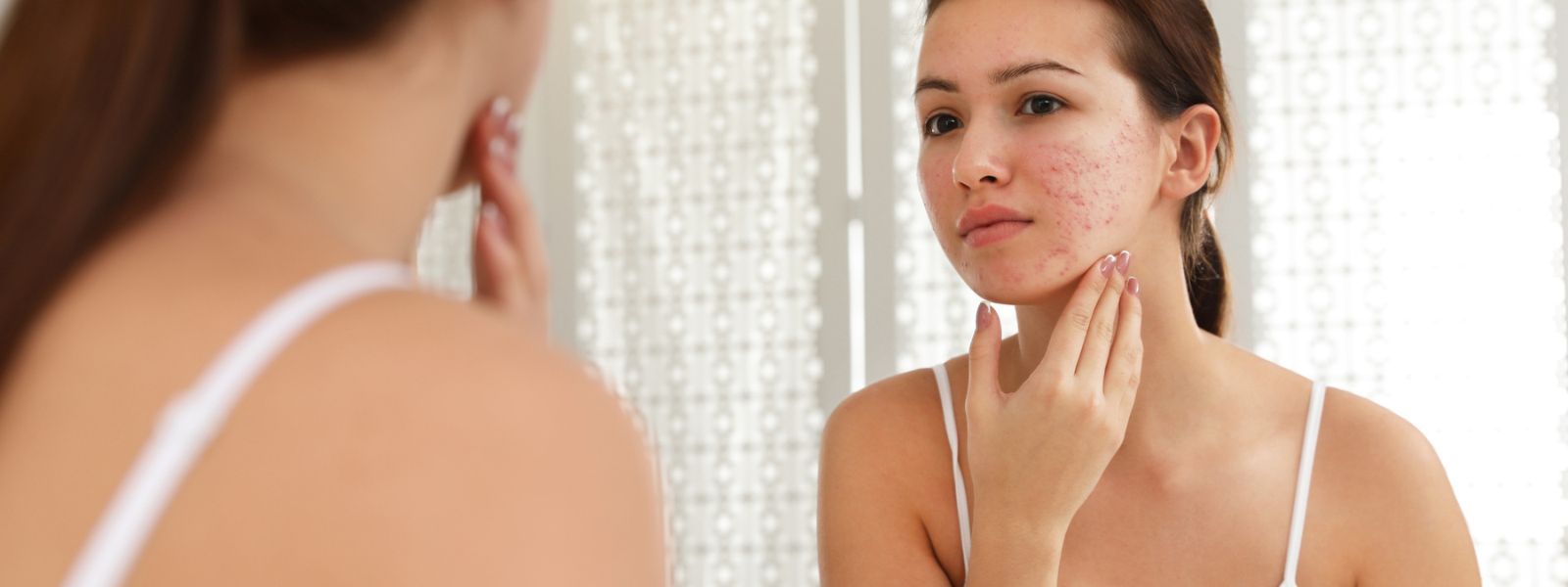Girl checking the facial scars through mirror.